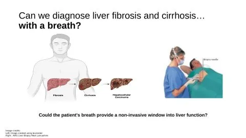 Representative slide from Can We Diagnose Liver Disease From A Breath?
