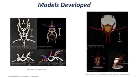 Representative slide from From Concept to Creation: 3D-Printed Models of the Circle of Willis as Anatomical Teaching Tools