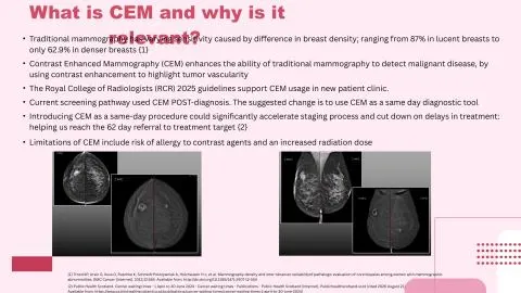 Representative slide from Introducing Contrast Enhanced Mammography (CEM) to the New Patient Clinic