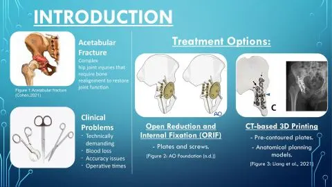 Representative slide from The Efficacy of 3D-Printed Patient Specific Acetabulum Implants
