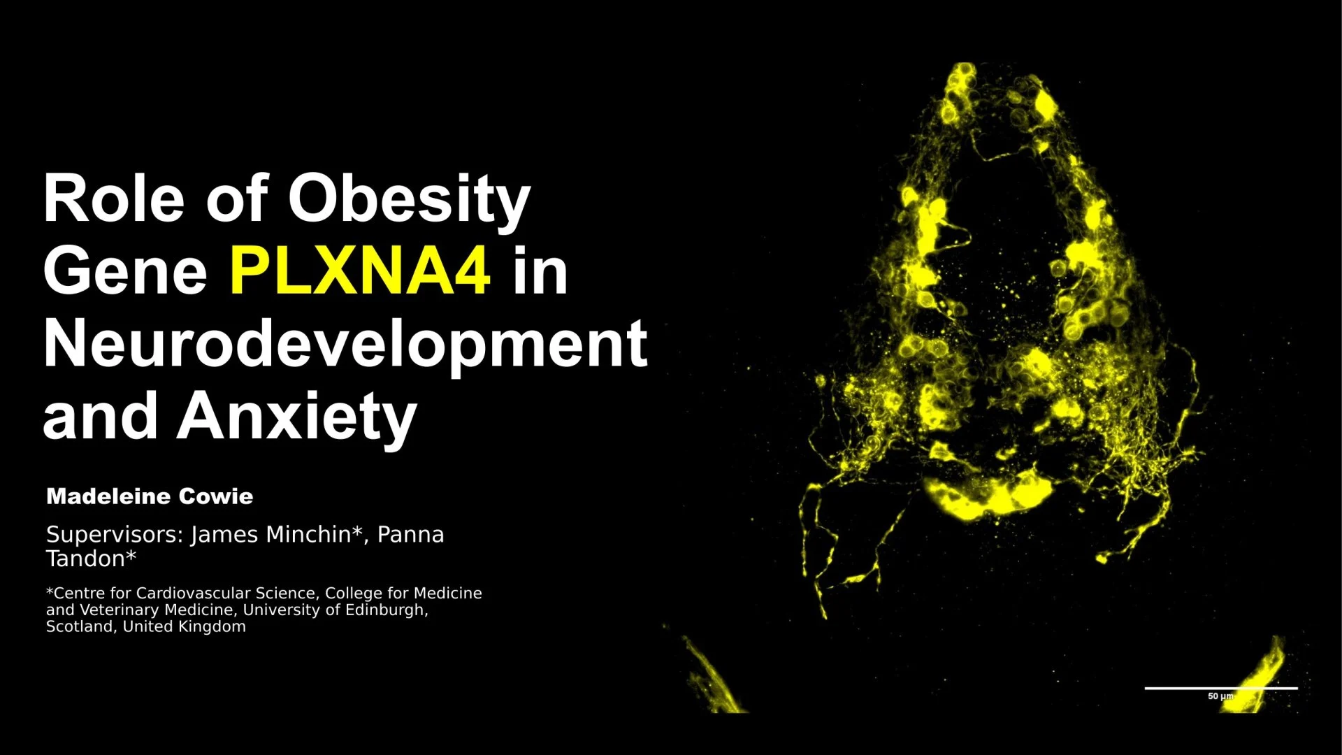 Slide 1: Role of Obesity Gene. A full description follows.
