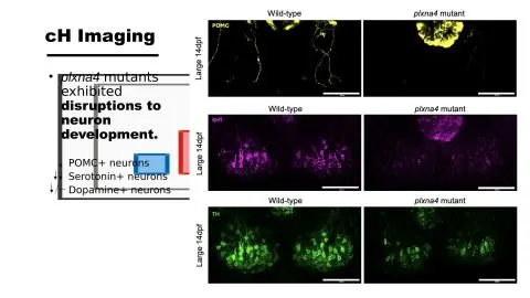 Representative slide from Role of Obesity Gene PLXNA4 in Neurodevelopment and Anxiety